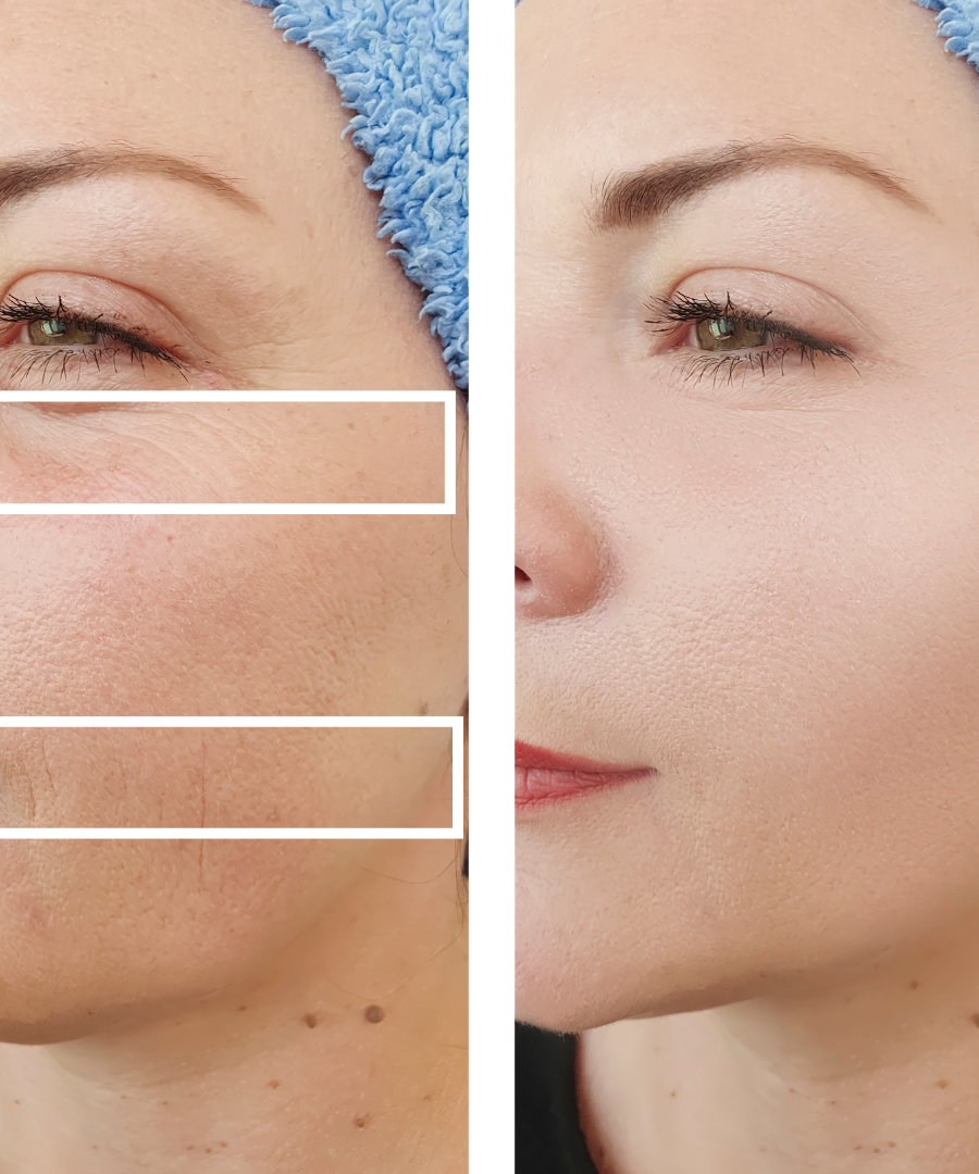 Revitalizing Eyes & Lips