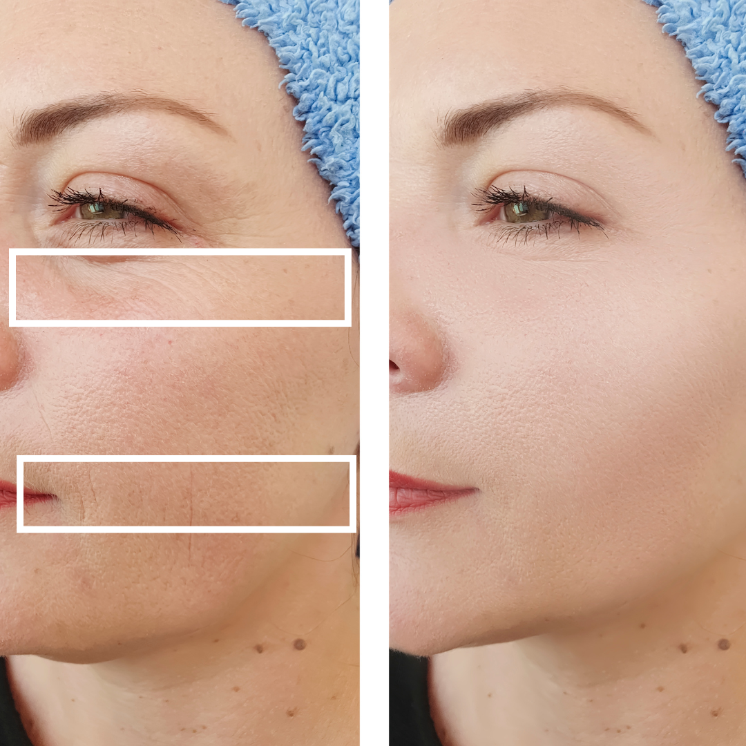 Revitalizing Eyes & Lips